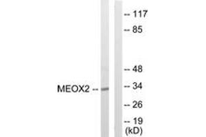 Western blot analysis of extracts from COLO205 cells, using MEOX2 Antibody. (MEOX2 anticorps  (AA 151-200))
