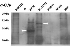 Western blot analysis of the cross-reactivity of antibodies directed against Campylobacter jejuni with different protein samples as provided by commercial HEK-293 overexpression lysates. (Campylobacter jejuni anticorps)