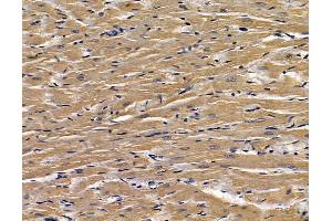 ABIN7095188 and ABIN7099244 at 1/100 staining rat heart tissue by IHC-P. (CLIC5 anticorps)