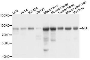 Western blot analysis of extracts of various cell lines, using MUT antibody. (MUT anticorps  (AA 451-750))