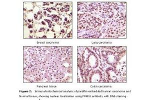 Image no. 1 for anti-Peroxisome Proliferator-Activated Receptor gamma (PPARG) antibody (ABIN232120)