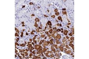 Immunohistochemical staining of human stomach with ZNF442 polyclonal antibody  shows strong cytoplasmic positivity in cells of tubules at 1:50-1:200 dilution. (ZNF442 anticorps)