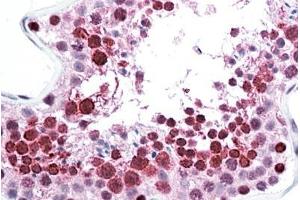 anti-Chromosome 22 Open Reading Frame 28 (C22orf28) (AA 201-215) antibody