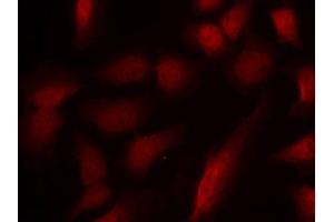 Immunofluorescence staining of methanol-fixed HeLa cells using Phospho-GATA1-S310 antibody (ABIN2988025). (GATA1 anticorps  (pSer310))
