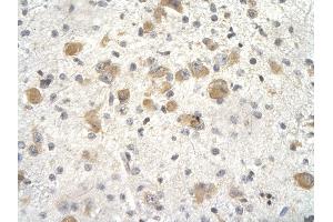 Rabbit Anti-KCTD3 Antibody       Paraffin Embedded Tissue:  Human neural cell   Cellular Data:  Epithelial cells of renal tubule  Antibody Concentration:   4. (KCTD3 anticorps  (Middle Region))