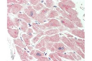 Human Heart: Formalin-Fixed, Paraffin-Embedded (FFPE).