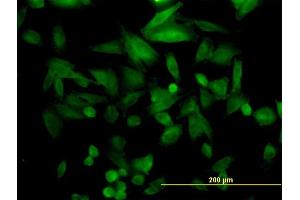 Immunofluorescence of monoclonal antibody to FHL5 on HepG2 cell.