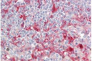 Anti-ORM1 / Orosomucoid antibody IHC staining of human spleen.