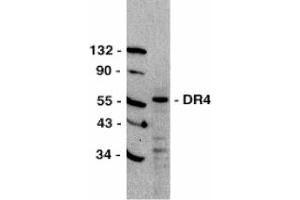 Image no. 1 for anti-Tumor Necrosis Factor Receptor Superfamily, Member 10a (TNFRSF10A) (C-Term) antibody (ABIN201644) (TNFRSF10A anticorps  (C-Term))