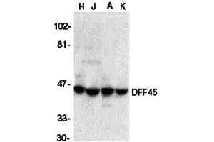 Western Blotting (WB) image for anti-DNA Fragmentation Factor, 45kDa, alpha Polypeptide (DFFA) (C-Term) antibody (ABIN1030360) (DFFA anticorps  (C-Term))