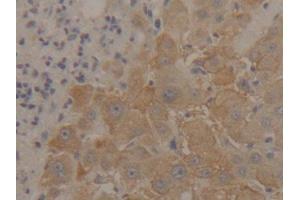 DAB staining on IHC-P; Samples: Mouse Liver Tissue