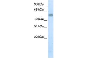 Western Blotting (WB) image for anti-Methyltransferase Like 3 (METTL3) antibody (ABIN2461900) (METTL3 anticorps)