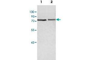 Western blot analysis of human fetal heart (Lane 1) and fetal brain (Lane 2) lysate with ZBED5 polyclonal antibody  at 1 : 500 dilution. (ZBED5 anticorps  (AA 224-474))