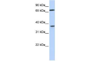 WB Suggested Anti-MAP2K3 Antibody Titration:  0.