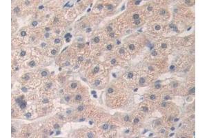 Detection of HAND1 in Human Liver Tissue using Polyclonal Antibody to Heart And Neural Crest Derivatives Expressed Protein 1 (HAND1)