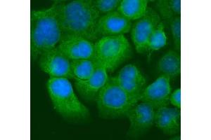 IF analysis of Krt20 using anti-Krt20 antibody (ABIN7601133). (KRT20 anticorps  (AA 29-431))