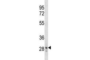 SNAI3 antibody western blot analysis in T47D lysate. (SNAI3 anticorps  (AA 1-29))