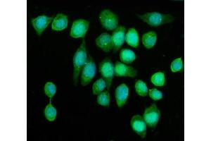 IF analysis of KIF2A using anti-KIF2A antibody (ABIN7600510). (KIF2A anticorps  (AA 2-706))
