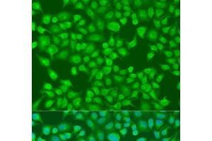 Immunofluorescence analysis of U2OS cells using ACOX1 Polyclonal Antibody at dilution of 1:100. (ACOX1 anticorps)