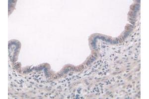 Figure. (ADAMTS7 anticorps  (AA 226-437))