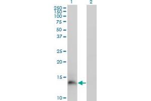 Western Blot analysis of PI3 expression in transfected 293T cell line by PI3 monoclonal antibody (M02), clone 2G20.
