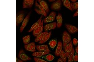 Immunofluorescence Analysis of Human HeLa cells labeling Emerin with Emerin Mouse Monoclonal Antibody (EMD/2167) followed by Goat anti-Mouse IgG-CF488 (Green). (Emerin anticorps  (AA 56-167))
