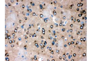 Anti- ROCK2 Picoband antibody,IHC(P) IHC(P): Rat Brain Tissue (ROCK2 anticorps  (AA 652-923))