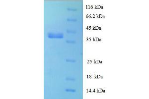 SDS-PAGE (SDS) image for Ribosomal Protein L28 (RPL28) (AA 2-137) protein (GST tag) (ABIN5710274)