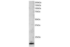 Image no. 1 for anti-Telomeric Repeat Binding Factor 2 (TERF2) (C-Term) antibody (ABIN374265) (TRF2 anticorps  (C-Term))