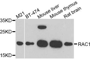 Western blot analysis of extracts of various cell lines, using RAC1 antibody. (RAC1 anticorps)
