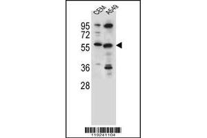 Western blot analysis in CEM,A549 cell line lysates (35ug/lane). (CSAD anticorps  (AA 197-226))