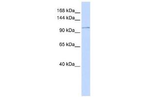 ATP2B3 antibody used at 1 ug/ml to detect target protein. (ATP2B3 anticorps  (N-Term))