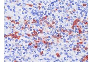 Image no. 1 for anti-S100 Calcium Binding Protein A8 (S100A8) antibody (ABIN379948) (S100A8 anticorps)