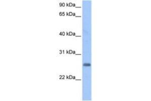 Western Blotting (WB) image for anti-Zinc Finger Protein Pseudogene (LOC728743) antibody (ABIN2463386) (LOC728743 anticorps)