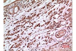 Immunohistochemistry (IHC) analysis of paraffin-embedded Human Brain, antibody was diluted at 1:100. (p53 anticorps  (Tyr216))