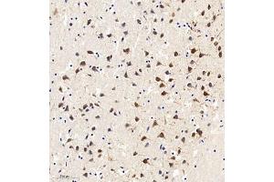 Immunohistochemistry of paraffin embedded mouse brain using MAP9 (ABIN7074622) at dilution of 1:750 (300x lens) (MAP9 anticorps)