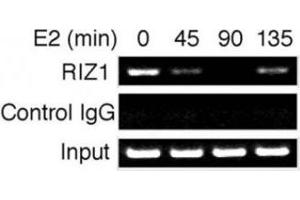Time course analysis of RIZ1 binding to the pS2 gene promoter. (PRDM2 anticorps  (AA 1-347))