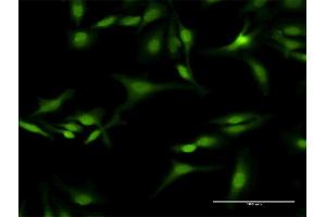 Immunofluorescence of purified MaxPab antibody to SEPT5 on HeLa cell. (Septin 5 anticorps  (AA 1-369))