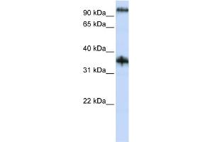 WB Suggested Anti-C9orf4 Antibody Titration:  0.