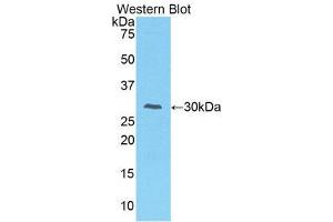 Western Blotting (WB) image for anti-Interleukin-1 Receptor-Associated Kinase 2 (IRAK2) (AA 211-458) antibody (ABIN3206500) (IRAK2 anticorps  (AA 211-458))