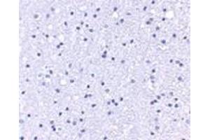 Immunohistochemistry (IHC) image for anti-Anaphase Promoting Complex Subunit 1 (ANAPC1) (C-Term) antibody (ABIN1030243) (APC1 anticorps  (C-Term))