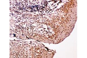 IHC-P: Caspase-14 antibody testing of human tonsil tissue (CASP14 anticorps  (AA 223-242))