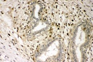 IHC analysis of S100A4 using anti-S100A4 antibody (ABIN7600462). (s100a4 anticorps  (AA 2-101))
