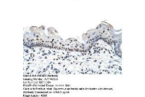 Rabbit Anti-RBM28 Antibody  Paraffin Embedded Tissue: Human Skin Cellular Data: Squamous epithelial cells Antibody Concentration: 4. (RBM28 anticorps  (C-Term))