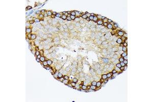 Immunohistochemistry of paraffin-embedded rat testis using USP9X Rabbit mAb (ABIN7271169) at dilution of 1:100 (40x lens). (USP9X anticorps)