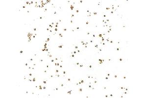 Immunocytochemistry (ICC) image for anti-CD79b Molecule, Immunoglobulin-Associated beta (CD79B) (AA 200-250) antibody (ABIN7454006) (Recombinant CD79b anticorps  (AA 200-250))