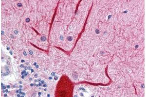 Human Brain, cerebellum: Formalin-Fixed, Paraffin-Embedded (FFPE) (ENPEP anticorps  (AA 689-932))