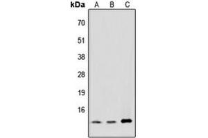 Western blot analysis of MED11 expression in HeLa (A), NIH3T3 (B), PC12 (C) whole cell lysates. (MED11 anticorps  (Center))