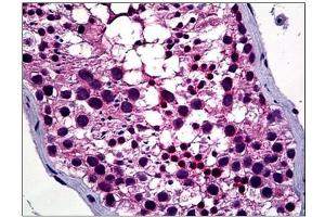 Human Testis: Formalin-Fixed, Paraffin-Embedded (FFPE) (HDAC6 anticorps  (N-Term))
