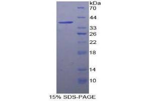 SDS-PAGE analysis of Human Fatty Acid Synthase Protein.